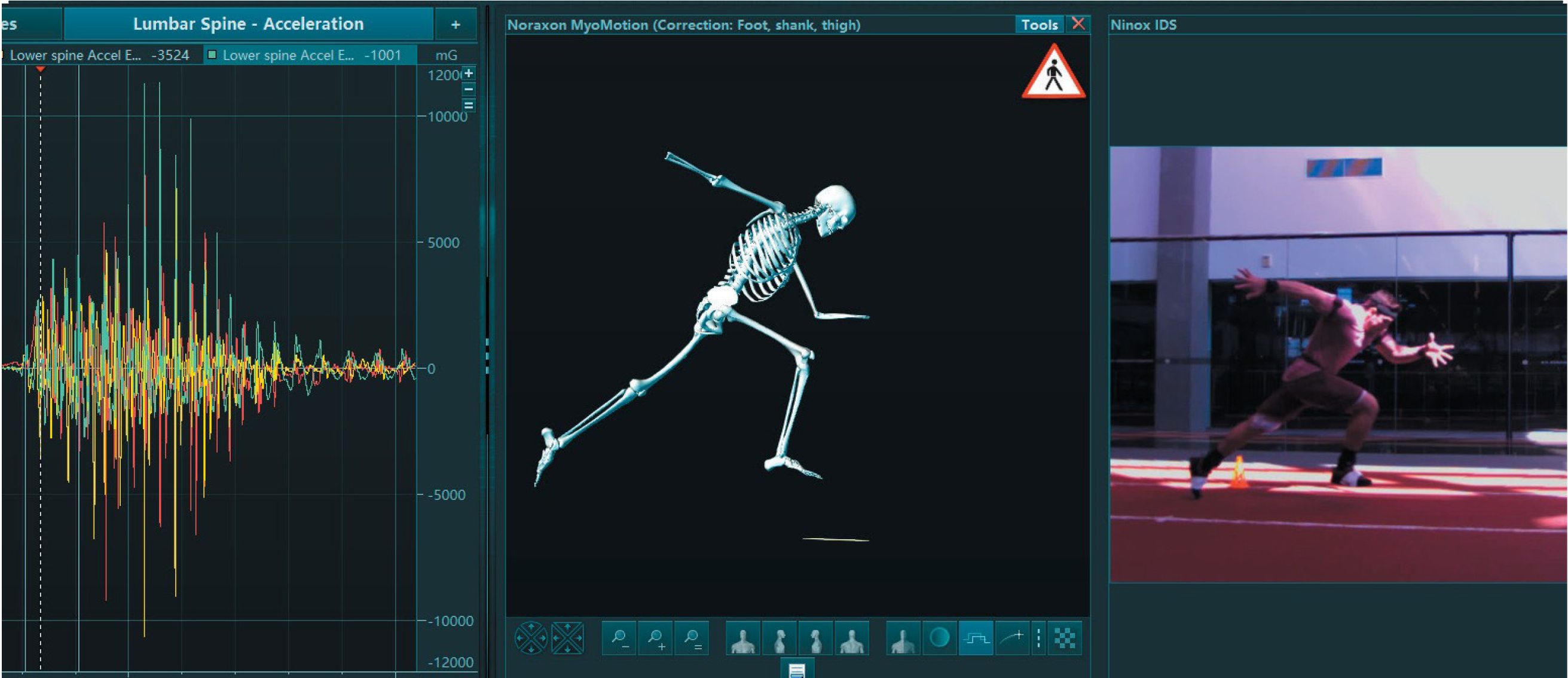 MyoMotion 3D运动捕捉系统 MyoMotion 3D运动捕捉系统