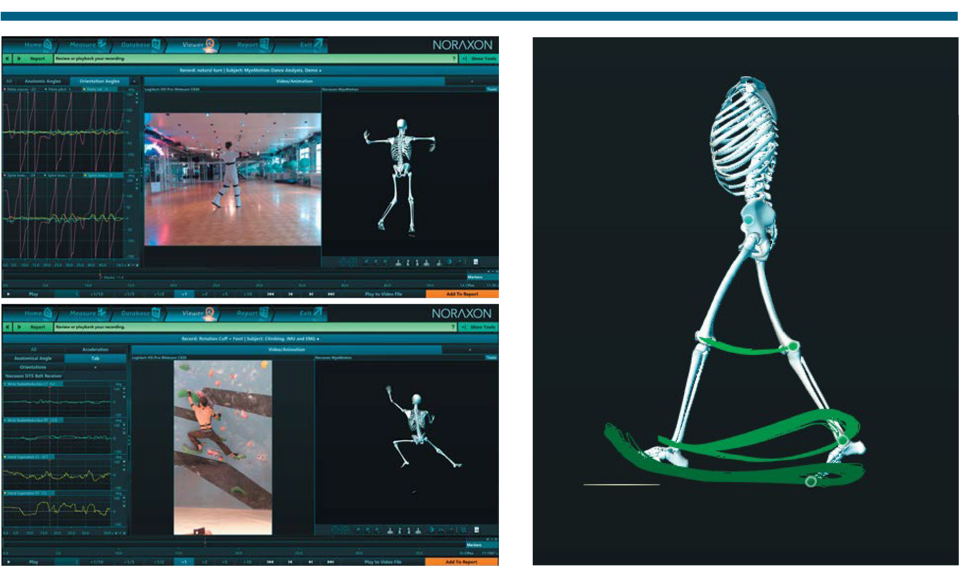 MyoMotion 3D运动捕捉系统 MyoMotion 3D运动捕捉系统
