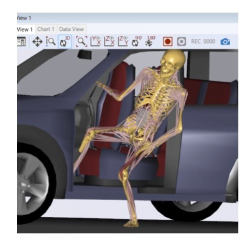 The AnyBody ModelingSystem