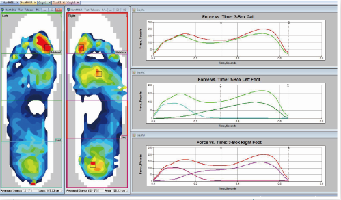 Tekscan F-Scan 鞋垫式足底压力分布测试系统