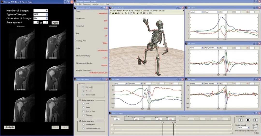 Qualisys三维运动捕捉系统