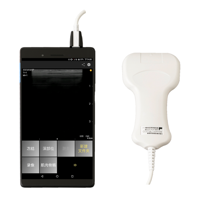 便携式超声诊断仪miruco