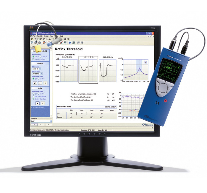 丹麦科研型耳声阻抗测量仪耳听霏 OTOflex 100