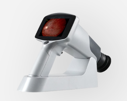 美沃手持式眼底照相机FC161