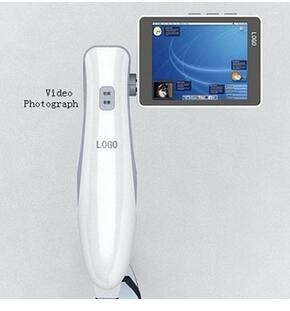 视频麻醉咽喉镜