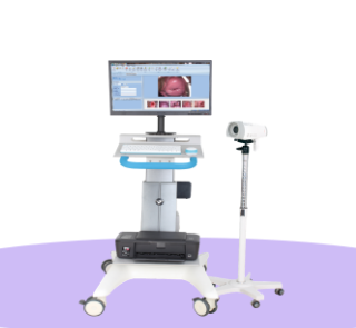 索吉瑞  经典款 数码电子阴道镜 SJR-YD