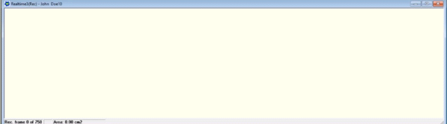 来自Strideway系统的实际记录。