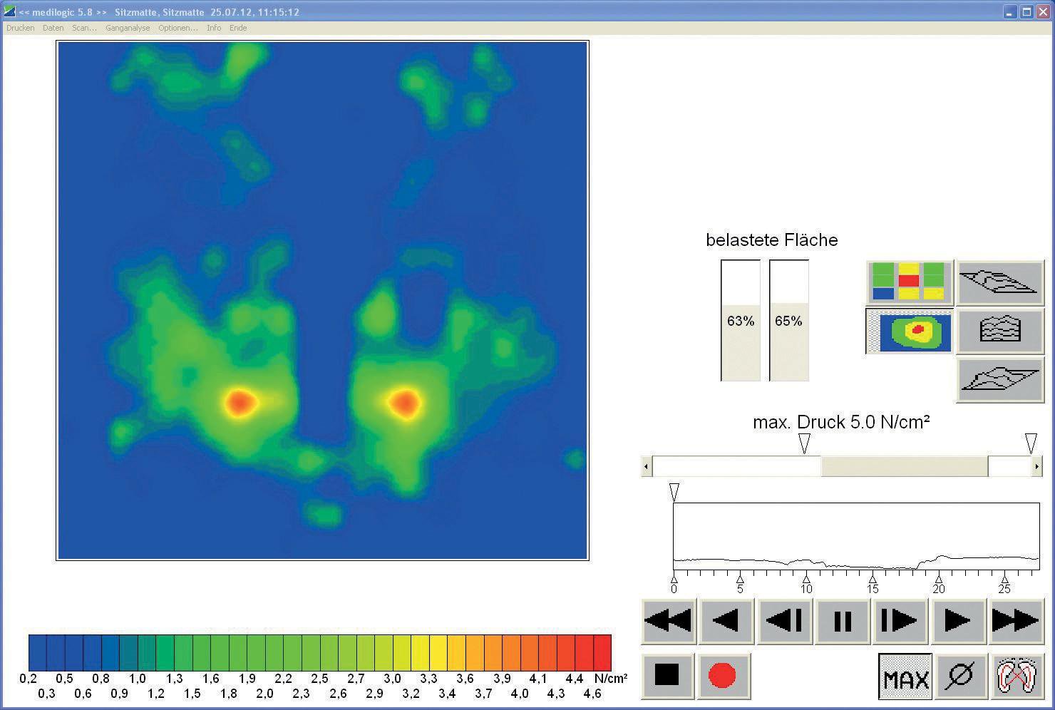 德国Medilogic坐垫式压力分布测量系统