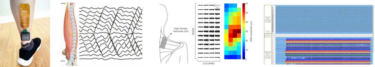 OT便携式高密度矩阵肌电测试系统 OT便携式高密度矩阵肌电测试系统